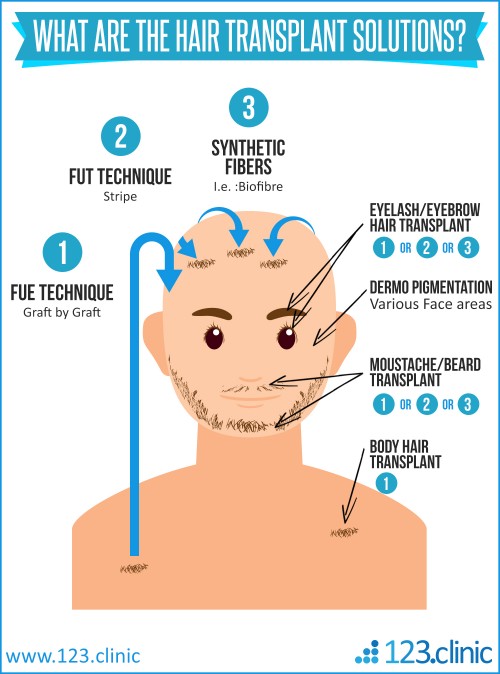 hair-transplant---hair-implant---123.clinic.jpg